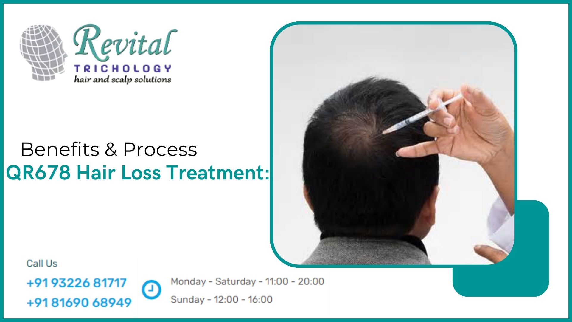 QR678 hair loss treatment-Benefit, Side Effects & Process
