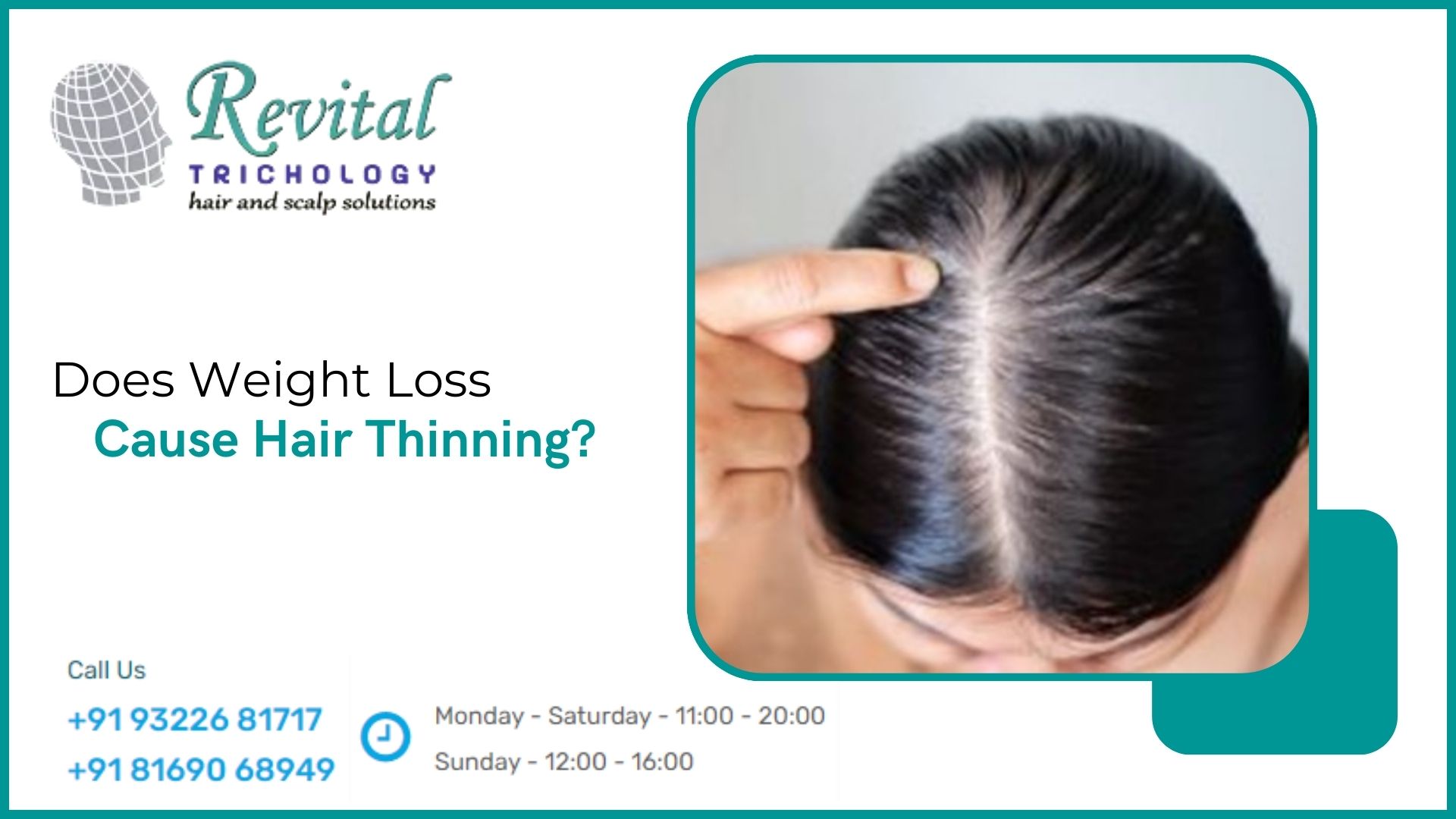 Does Losing Weight Cause Hair Loss and Thinning Over Time?