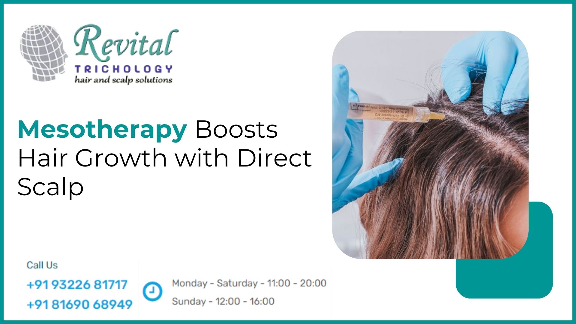 How Mesotherapy Boosts Hair Growth with Direct Scalp Nutrient Therapy