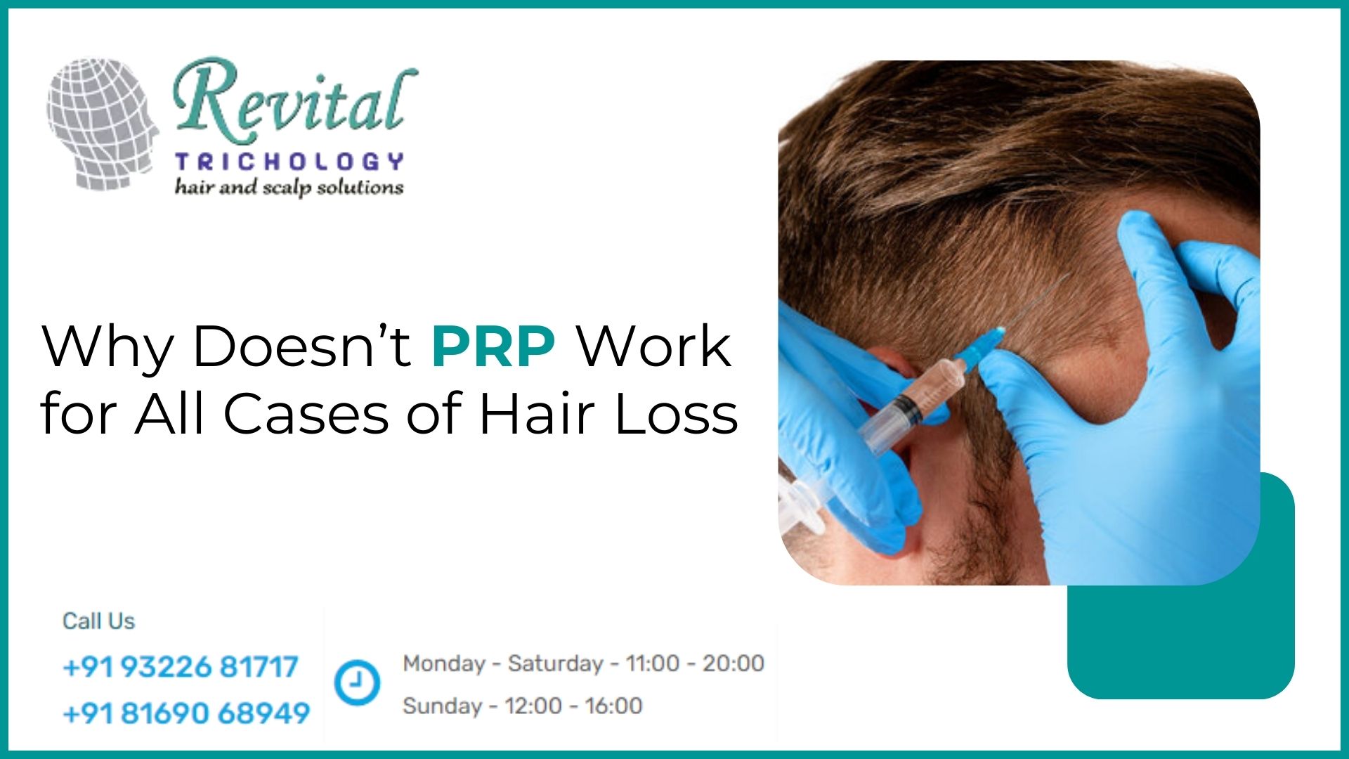 Why Doesn’t PRP Work for All Cases of Hair Loss