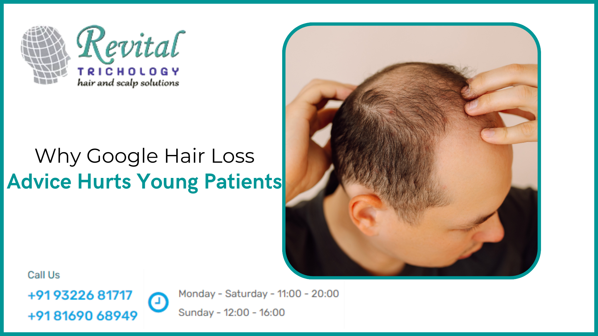 Why Google Hair Loss Advice Can Be Dangerous for Young Patients