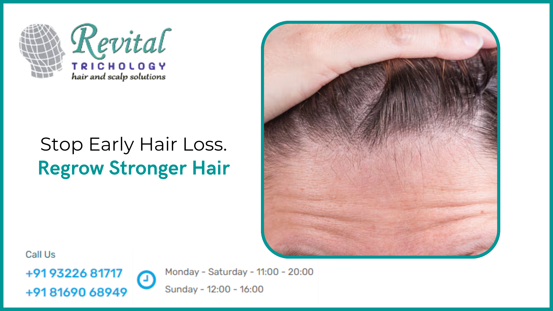 Is Hair Regrowth Possible After Early Hair Loss? What Actually Works