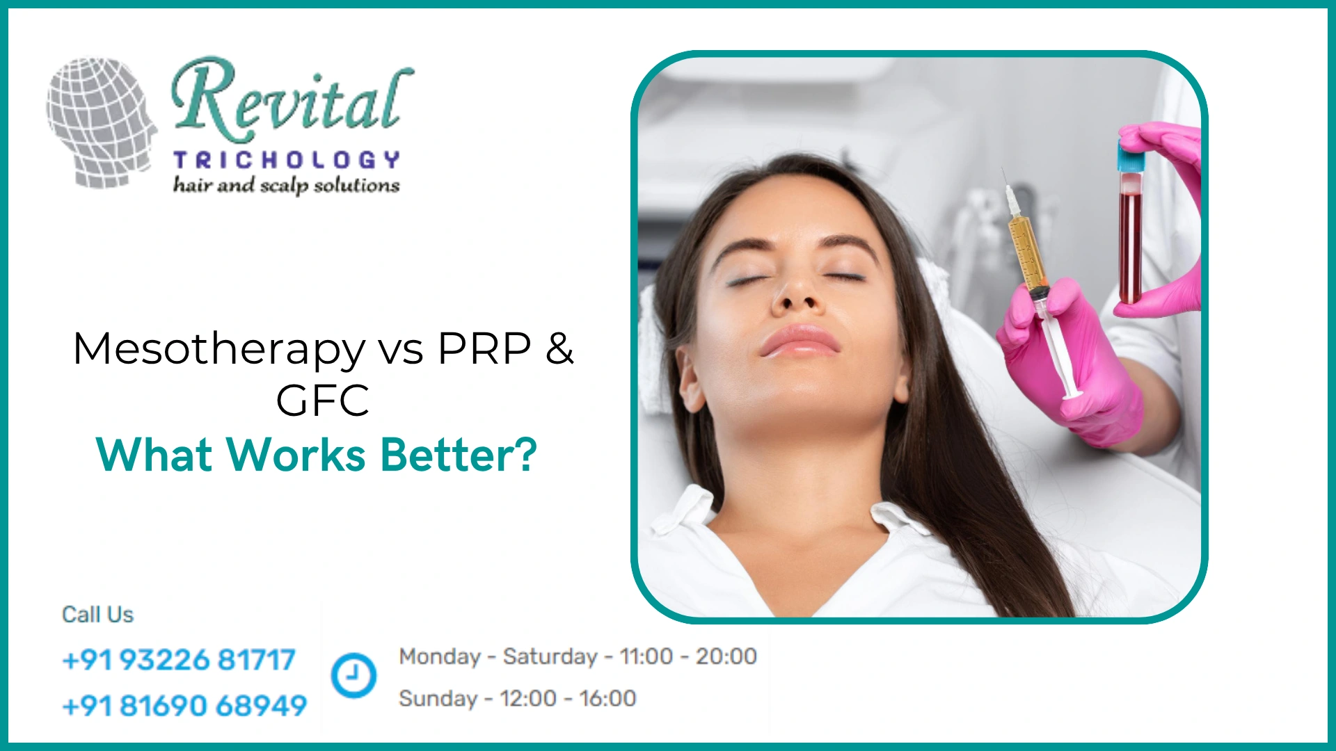 Why Does Mesotherapy Work Better Than PRP or GFC in Many Cases?