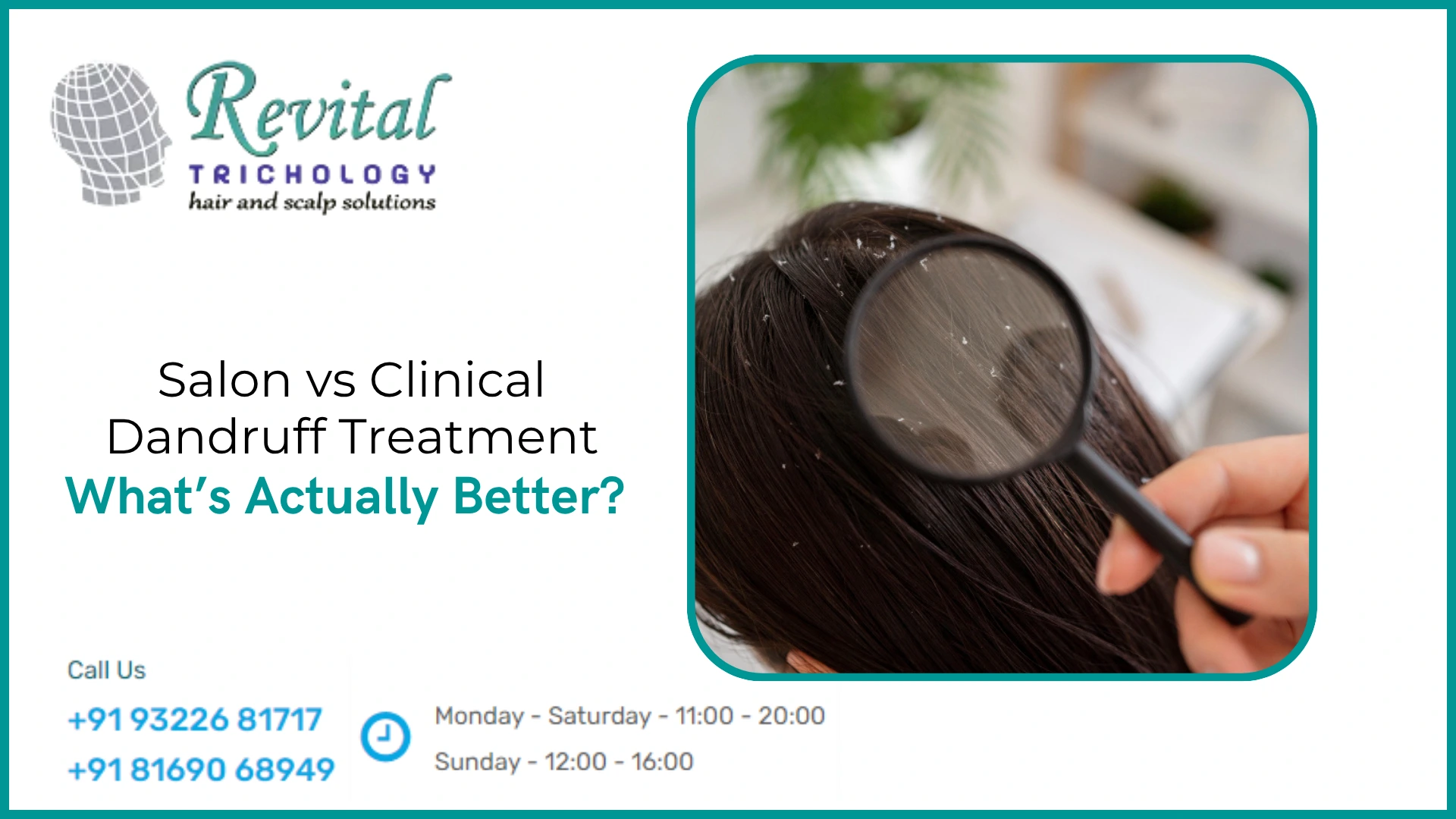 Salon vs Clinical Dandruff Treatment: What’s Better for You?