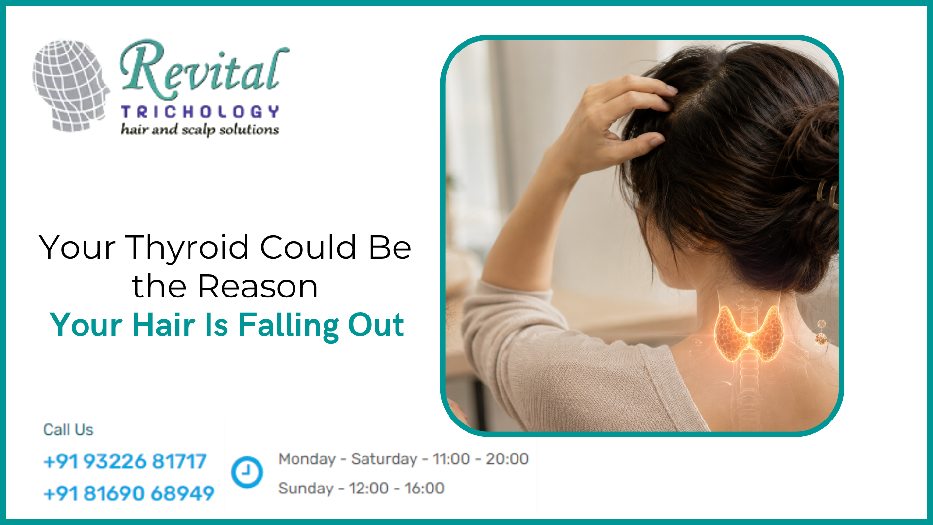 Your Thyroid Could Be the Reason Your Hair Is Falling Out — And Most Doctors Miss It