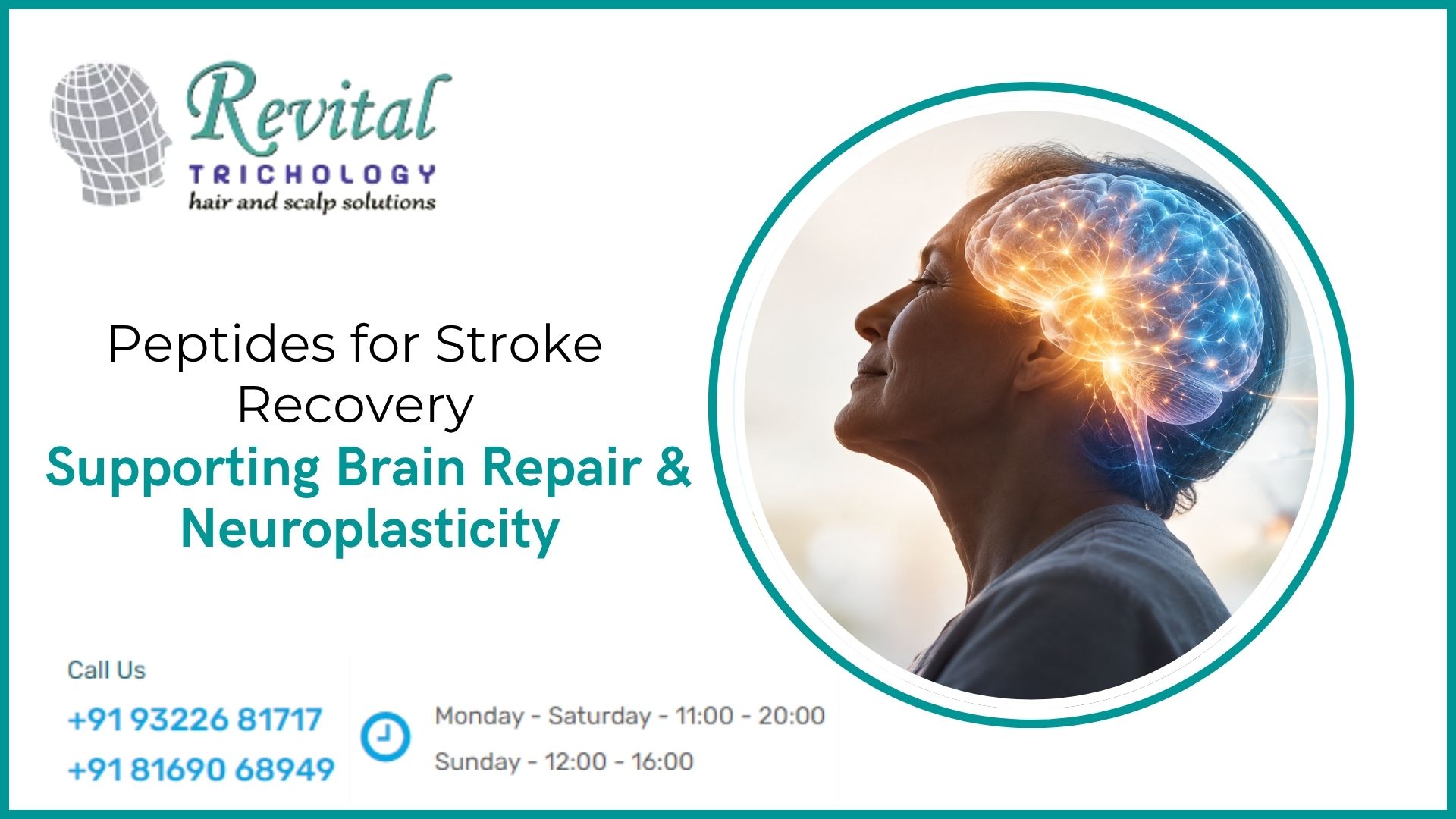 Which Peptides Can Help After a Stroke? Peptides for Brain Recovery, Neuroplasticity & Repair