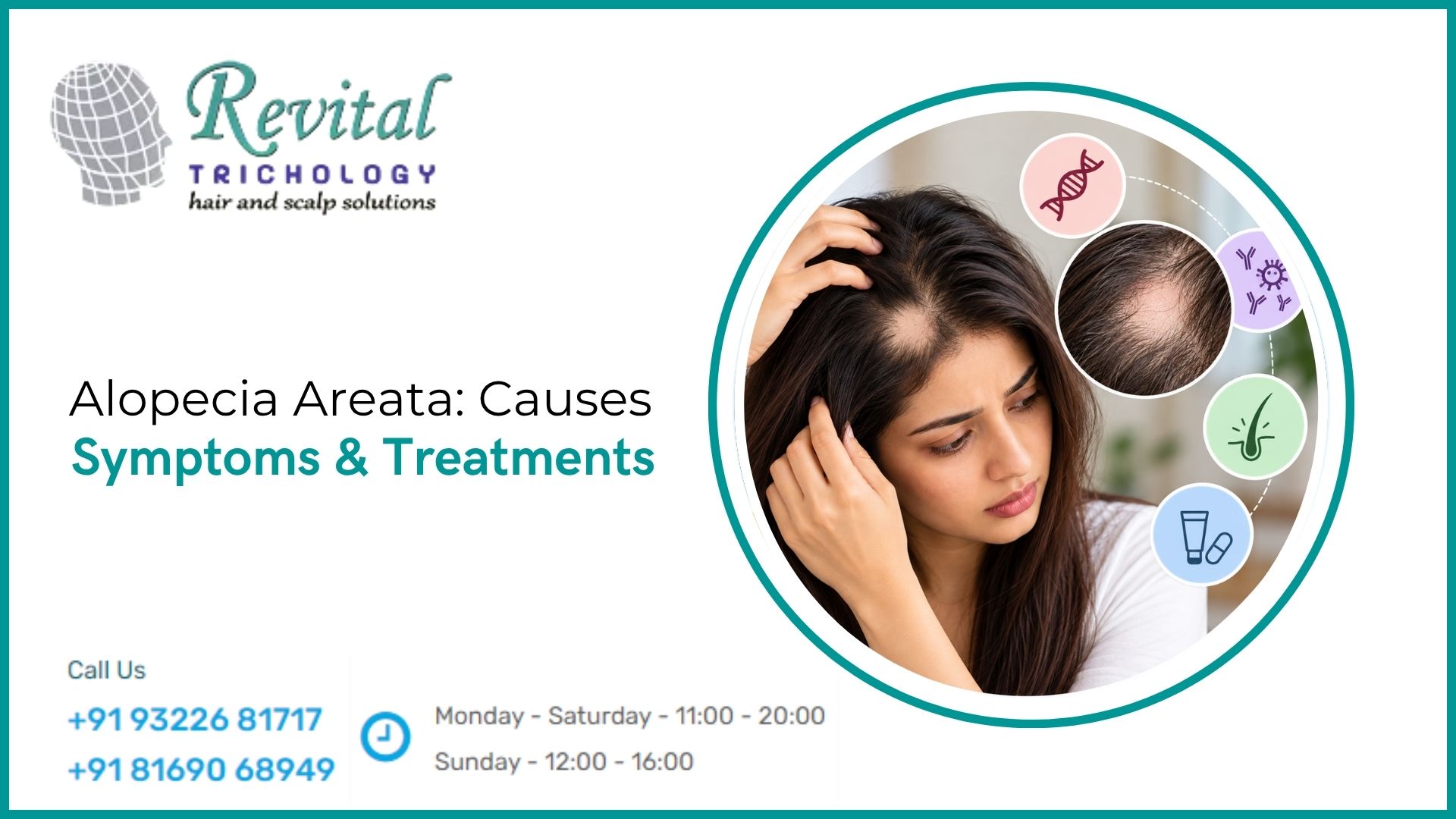 Alopecia Areata: Causes, Symptoms & Treatment Options